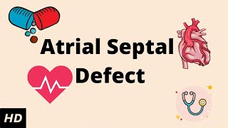 ATRIAL SEPTAL DEFECT ASD Causes Signs and Symptoms Diagnosis and Treatment [upl. by Okihcim]