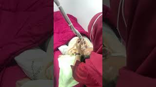 Fractional laser youtubeshorts youtube youtuber kesehatan kesehatanwajah skincaresehat [upl. by Cousins648]