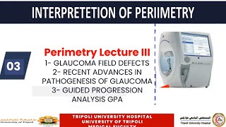 UNDERSTAND PERIMETRY IN GLAUCOMA 3 [upl. by Estelle]