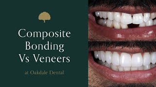 Composite Bonding vs Veneers [upl. by Nolana]