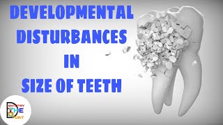 DEVELOPMENTAL DISTURBANCES IN SIZE OF TEETH [upl. by Pietje]