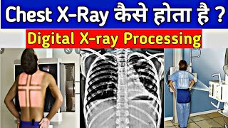 Chest Xray कैसे किया जाता है  Inside Xray Room  Digital Xray Procedure Step by Step  UdayXray [upl. by Lukash888]