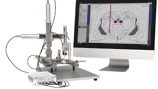 Neurostar  Robot Stereotaxic [upl. by Taka]