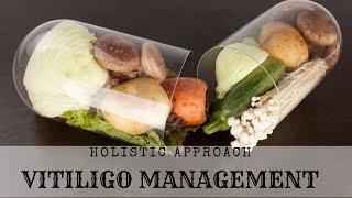 Holistic Approach to​ Managing Vitiligo  Treat Vitiligo Naturally [upl. by Aeel]