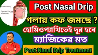 গলায় কফ জমে   হোমিওপ্যাথিতেই দূর হবে ম্যাজিকের মত  homeopathy medicine for Post Nasal Drip [upl. by Cohl451]