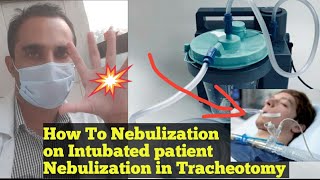 Nebulization on ventilator  how to give nebulization via tracheostomy  How to Nebulize ETT [upl. by Neeroc374]