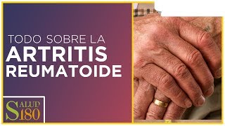 Tratamiento para la artritis reumatoide  Salud180 [upl. by Accever]