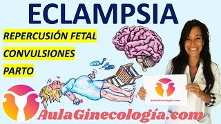 ECLAMPSIA PATOGÉNESIS CLÍNICA MEDIDAS GENERALES TRATAMIENTO PARTO Ginecología y Obstetricia [upl. by Ahsinav74]