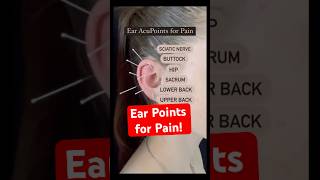 Ear Acupuncture for Back Pain Shorts [upl. by Yeldua79]