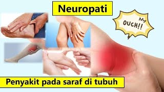 Neuropati  Yuk Kenali sejak dini gejala penyebab dan pengobatannya [upl. by Oile765]