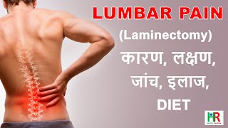 Lumbar Laminectomy in hindi What is lumbar laminectomy prevention after lumbar laminectomy [upl. by Acirre436]