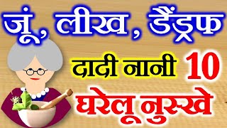 Lice Nits Removal Home Remedies  How to Get Rid of Dandruff  जूं लीख से छुटकारा पाने का उपाय [upl. by Mercier]