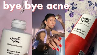 How To Get Rid of Acne Using Chemist At Play Serum  Chemist At Play Acne Control Serum Review [upl. by Nomead882]