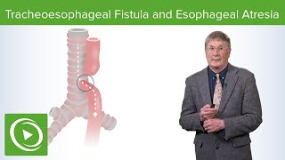 Tracheoesophageal Fistula and Esophageal Atresia  Lecturio Medical [upl. by Asalocin]