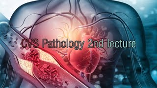 Rheumatic Fever and Infective endocarditis lecture [upl. by Guendolen680]