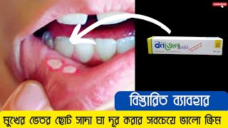 bongel oral gel  বনজেল ওরাল জেল  মুখের ঘা দূর করার উপায়  bongel oral gel এর ব্যাবহারের নিয়ম [upl. by Imarej]