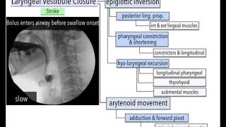 Epiglottic inversion strategies [upl. by Eeram]