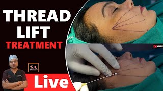 THREAD LIFT TREATMENT [upl. by Alohs]