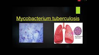 Pathogenesis of pulmonary tuberculosis [upl. by Ayoted]