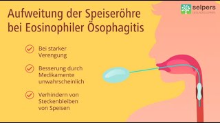 Aufweitung der Speiseröhre bei Eosinophiler Ösophagitis Arzt erklärt [upl. by Adnalra640]