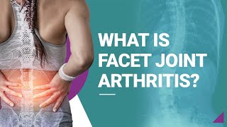 What is Facet Joint Arthritis [upl. by Lemak651]