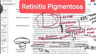 Retinitis Pigmentosa ophthalmology 18 First Aid USMLE Step 1 in Hindi  Urdu [upl. by Pate]