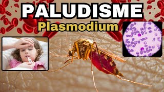 Tout savoir sur le PALUDISME  MALARIA  Plasmodium Cycle Diagnostic Traitement [upl. by Farnsworth693]