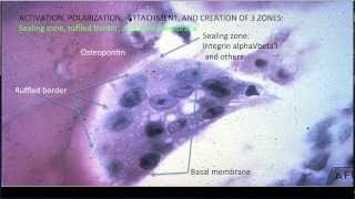 Learning Bone Growth 3 The Osteoclast [upl. by Vivie]