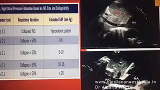 Transthoracic Echocardiography [upl. by Sudbury]