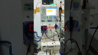 Dialysis with Fresenius 4008s OCM machine shortsfeed dialysis viralshort ytshorts [upl. by Merriman971]