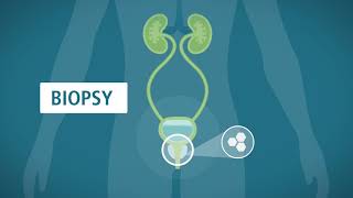 Prostate Biopsy What You Should Know  Urology Care Foundation [upl. by Siekram]