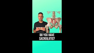 🔍 Suspecting Sacroiliitis 🔍 [upl. by Erv955]