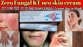 ketoconazole clobetasol propionate and neomycin sulfate tolnaftate lodochlorhydroxyquinoline cream [upl. by Leahcimsemaj]