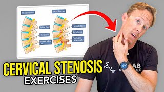 5 Exercises for Cervical Stenosis Arm Nerve Pain [upl. by Eicarg]