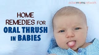 Home Remedies For Oral Thrush In Babies [upl. by Anagnos615]