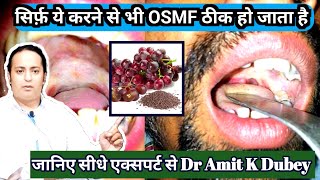 सिर्फ़ इसे खाने से OSMF ठीक होता हैं। OSMF submucousfibrosis  ओज treatment in India [upl. by Lithea329]