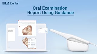 BLZ Dental Intraoral Scanner Oral Examination Report Using Guides [upl. by Saltsman]