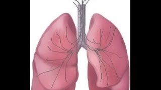 BREATH SOUNDS Stages of Fluid Overload Pneumonia [upl. by Neyr]