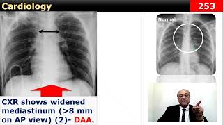 internalmedicine cme usmle محاضراتباطنة ecg كورساتباطنة clinical clinical medicine [upl. by Rahmann]