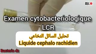 Examen cytobacteriologique du LCR liquide cephalo rachidien التحليل السيتوبكتريولوجي للسائل النخاعي [upl. by Twum]