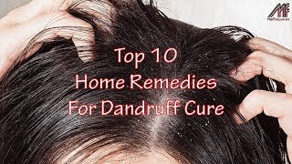 10 Home Remedies For Dandruff Cure 💇 Dandruff Treatment at Home👴 [upl. by Wadsworth]