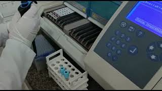 D  dimer test on Mini Vidas Biochemistry [upl. by Nol]