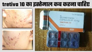 Tretiva 10 mg Capsule Uses  Isotretinoin Uses side Effects amp Dose In Hindi tretiva 10 mg benefits [upl. by Pattani]