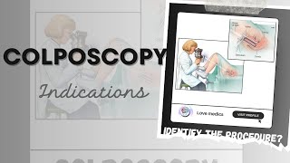 What is colposcopy  The diagnostic procedure Colposcope  Indication of colposcopy [upl. by Eneryt]