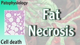 Pathophysiology  Fat Necrosis Hani Laith شرح [upl. by Trimble]