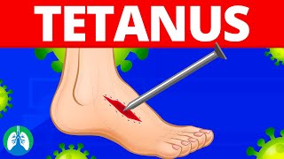 Tetanus Medical Definition  Quick Explainer Video [upl. by Mackay]