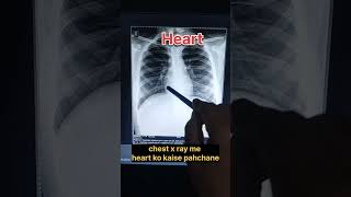 how to read chest xray  radiology  viral youtubeshorts radiology anatomy shorts biology [upl. by Ssilb]