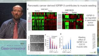 Cancer cachexia and sarcopenia in GI cancer Mechanism and ways to interfere with it [upl. by Wyon62]