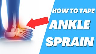 How to tape ankle sprain [upl. by Eadmund]