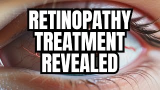 The BEST treatment for Diabetic Retinopathy [upl. by Jodie413]